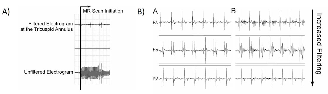 An external file that holds a picture, illustration, etc., usually as some form of binary object. The name of referred object is rmmj-1-2_e0015_Figure04.jpg